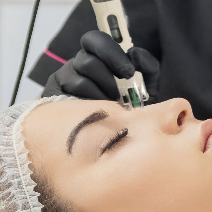 DermaFrac - Dermal Micro-Needling System