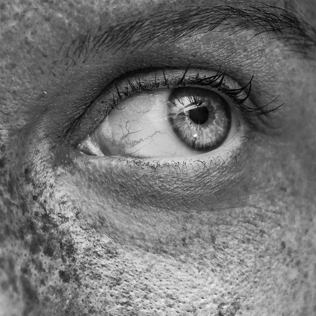 Sun Damaged Skin Products - Atone Skin Clinic