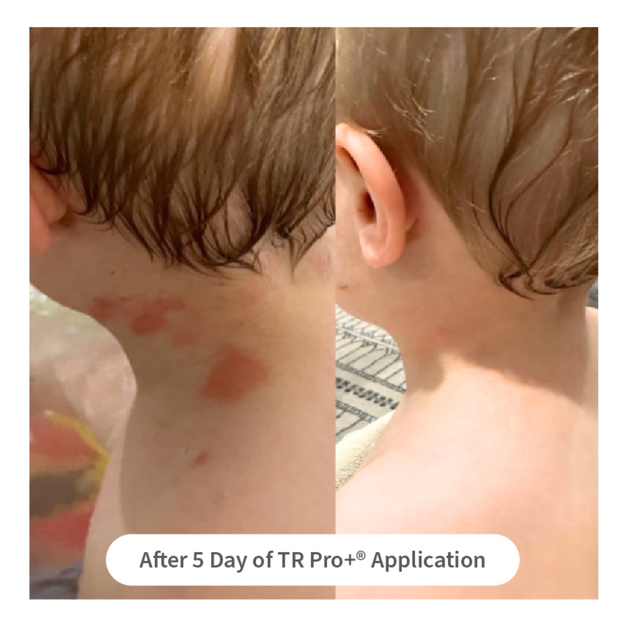 Tr Pro Tissue Repair TR Pro+ Hydrogel 10g | Game-Changing Skincare Solution ...
