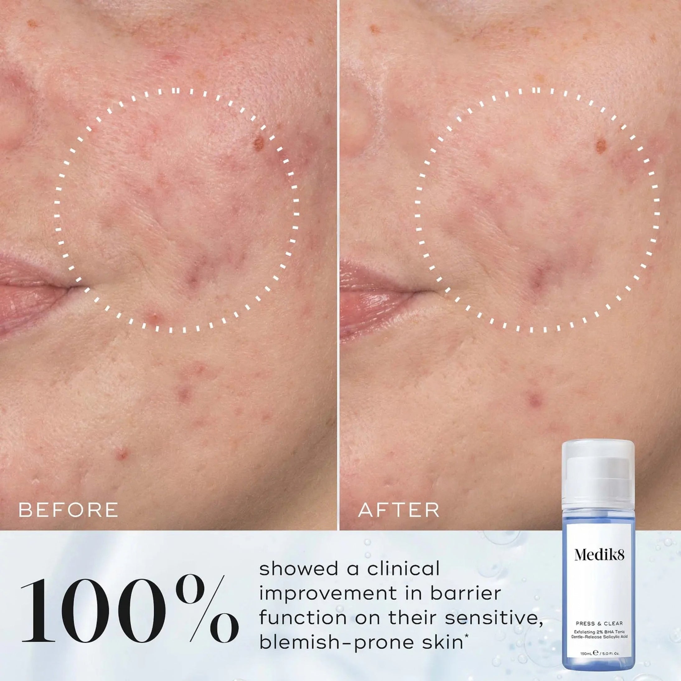 Medik8 Clear Skin Edit (Valued at $174)