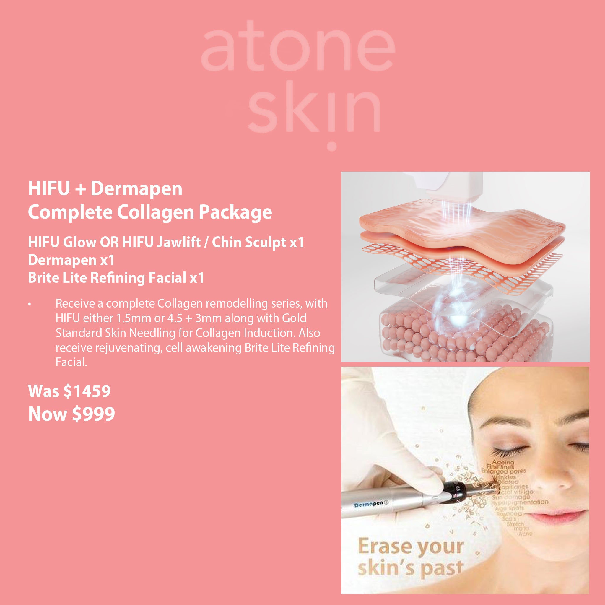 HIFU + Dermapen Complete Collagen Package
